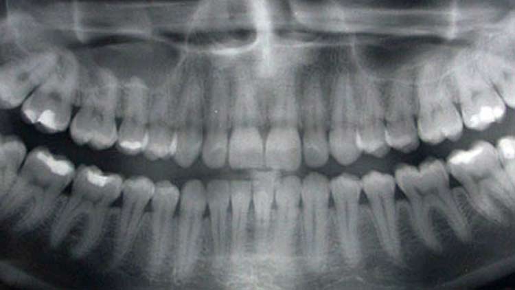 Digital Dental X-ray