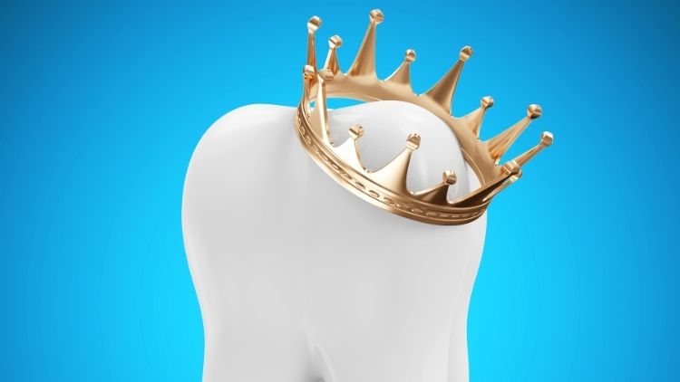 The 5 Types Of Dental Crowns Balog DDS Monroe Michigan